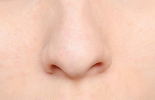 イチゴ鼻の原因とケア方法